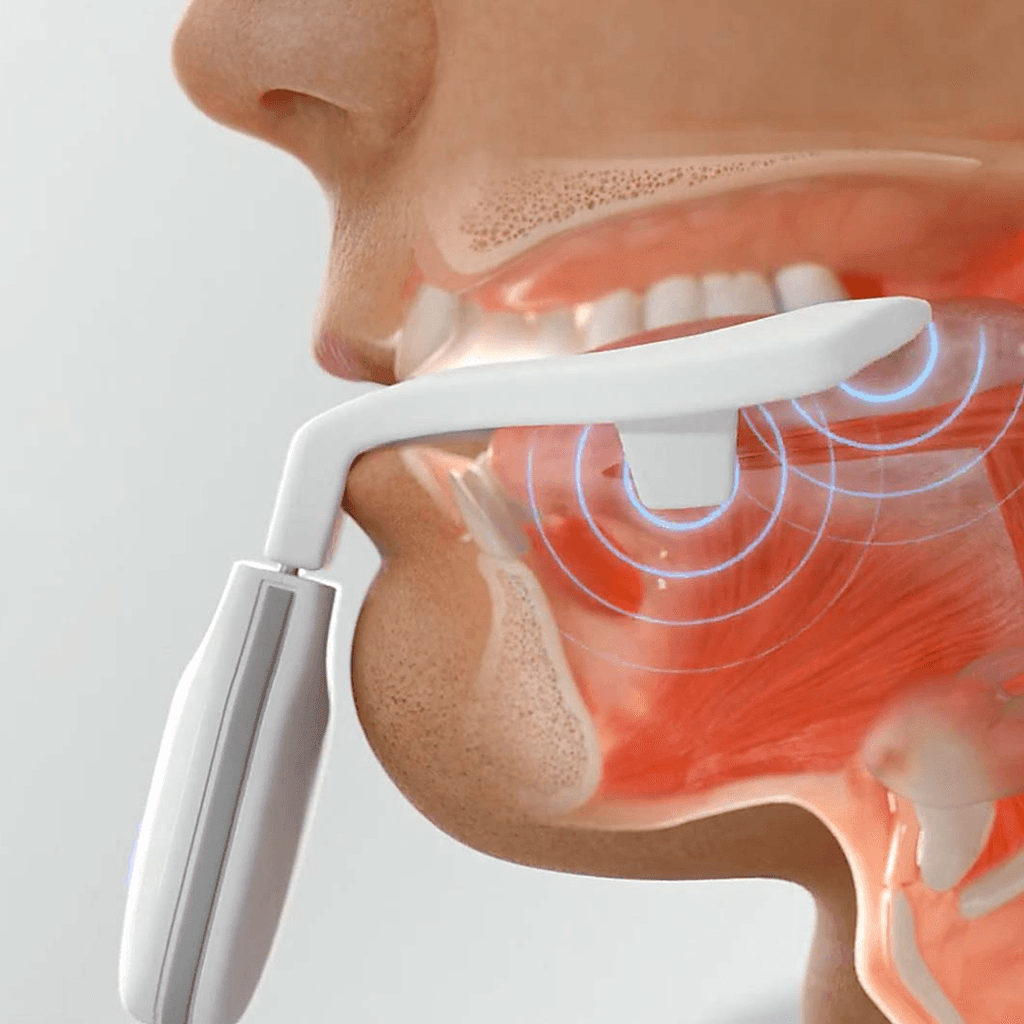 The Proof is in the Pudding - ExciteOSA Therapy Positive Results Mild Sleep Apnea